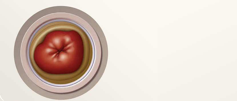 ein rot-weißer Kreis mit einem weißen Kreis in der Mitte